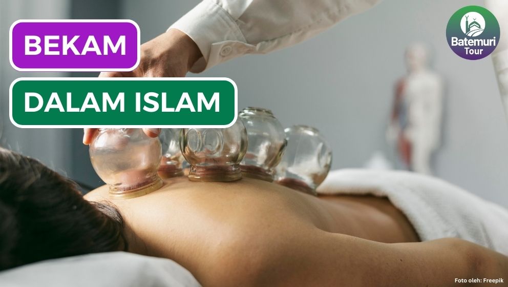 Manfaat Bekam dan Hukumnya dalam Islam